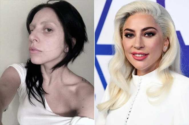 Lady Gaga